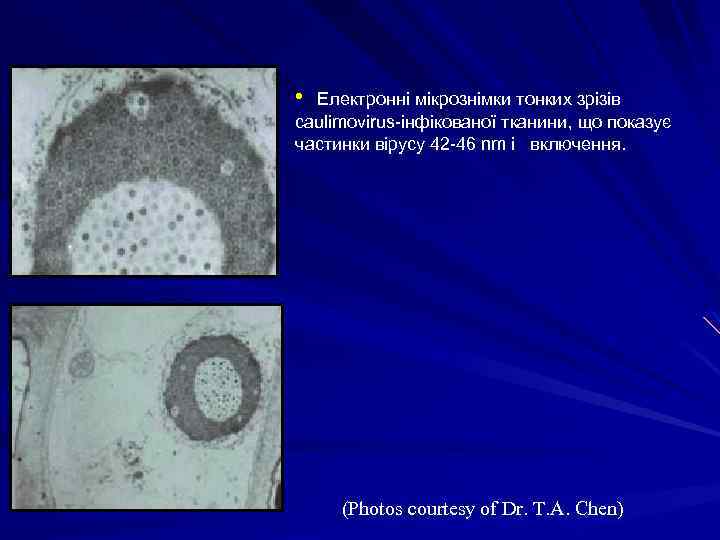  • Електронні мікрознімки тонких зрізів caulimovirus-інфікованої тканини, що показує частинки вірусу 42 -46