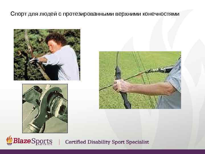 Спорт для людей с протезированными верхними конечностями 