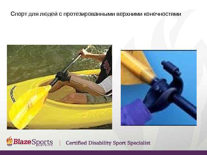 Спорт для людей с протезированными верхними конечностями 