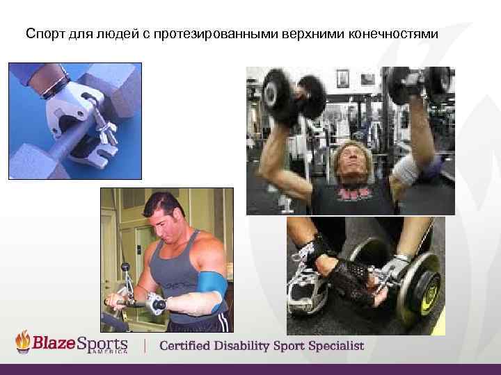 Спорт для людей с протезированными верхними конечностями 