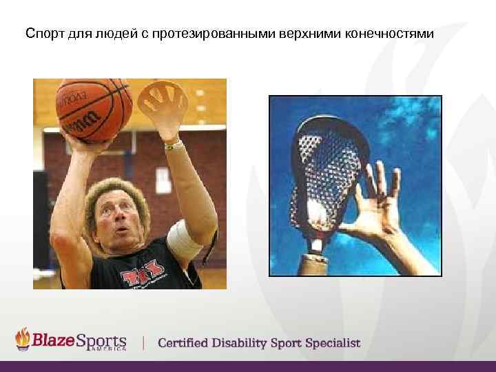 Спорт для людей с протезированными верхними конечностями 