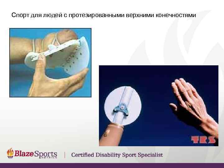 Спорт для людей с протезированными верхними конечностями 