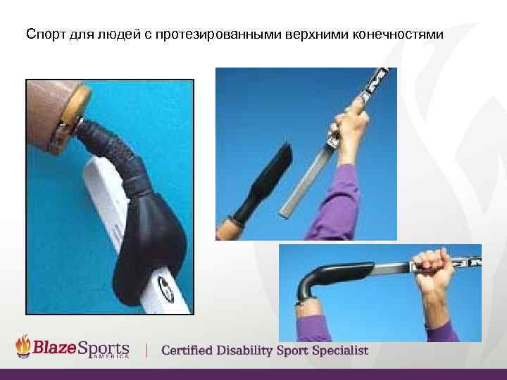 Спорт для людей с протезированными верхними конечностями 