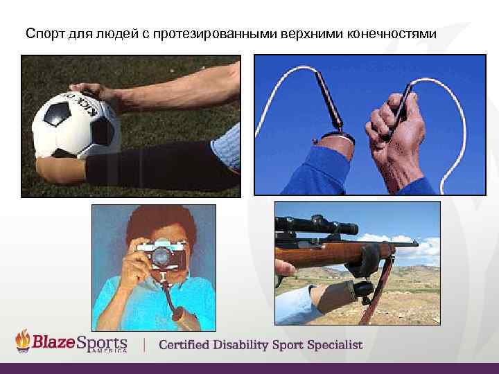 Спорт для людей с протезированными верхними конечностями 
