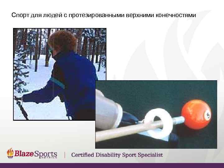 Спорт для людей с протезированными верхними конечностями 