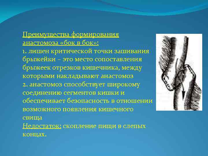 Преимущества формирования анастомоза «бок в бок» : 1. лишен критической точки зашивания брыжейки –