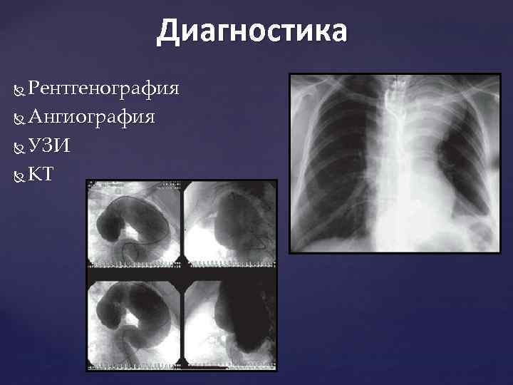 Диагностика Рентгенография Ангиография УЗИ КТ 