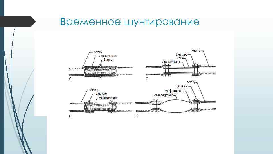 Разрешается ли шунтирование и расшунтирование