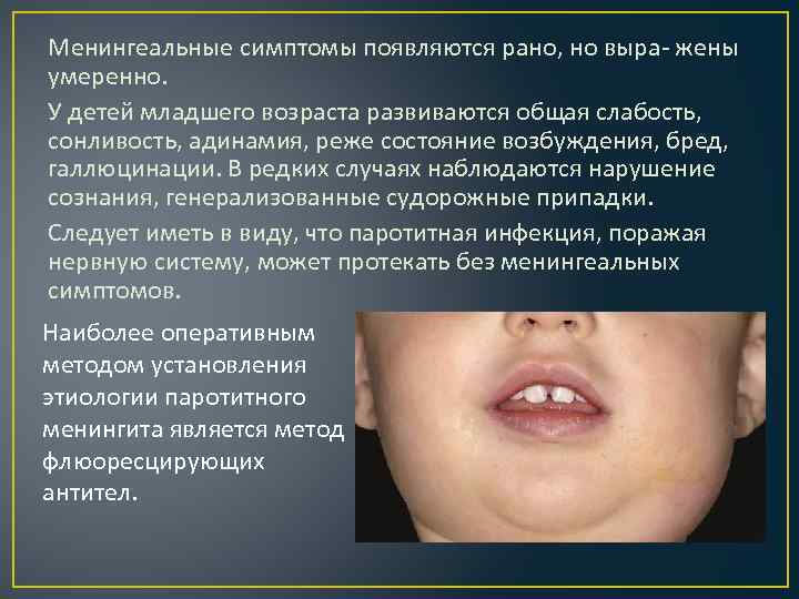 Менингеальные симптомы появляются рано, но выра- жены умеренно. У детей младшего возраста развиваются общая