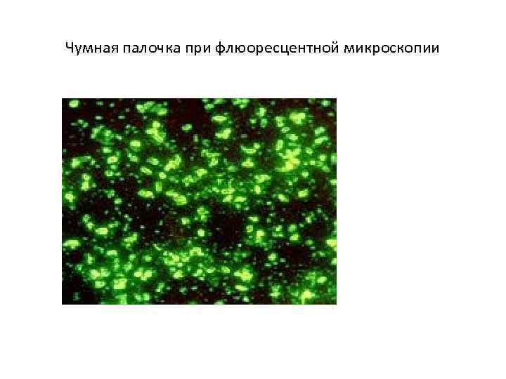 Чумная палочка при флюоресцентной микроскопии 