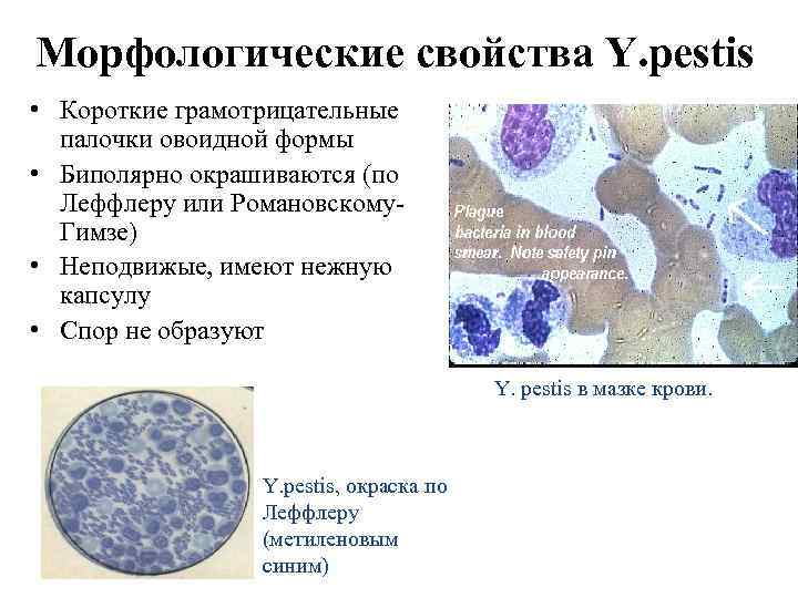 Морфологические свойства Y. pestis • Короткие грамотрицательные палочки овоидной формы • Биполярно окрашиваются (по