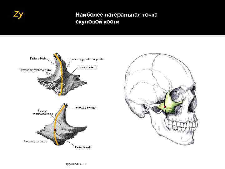 Zy Наиболее латеральная точка скуловой кости Фролов А. О. 