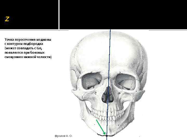 Z Точка пересечения медианы с контуром подбородка (может совпадать с Gn, появляется при боковых