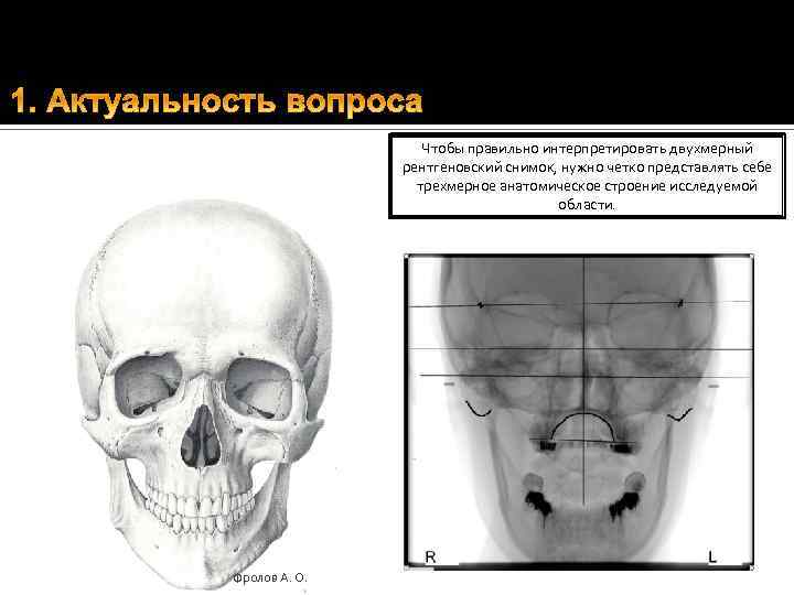 Чтобы правильно интерпретировать двухмерный рентгеновский снимок, нужно четко представлять себе трехмерное анатомическое строение исследуемой