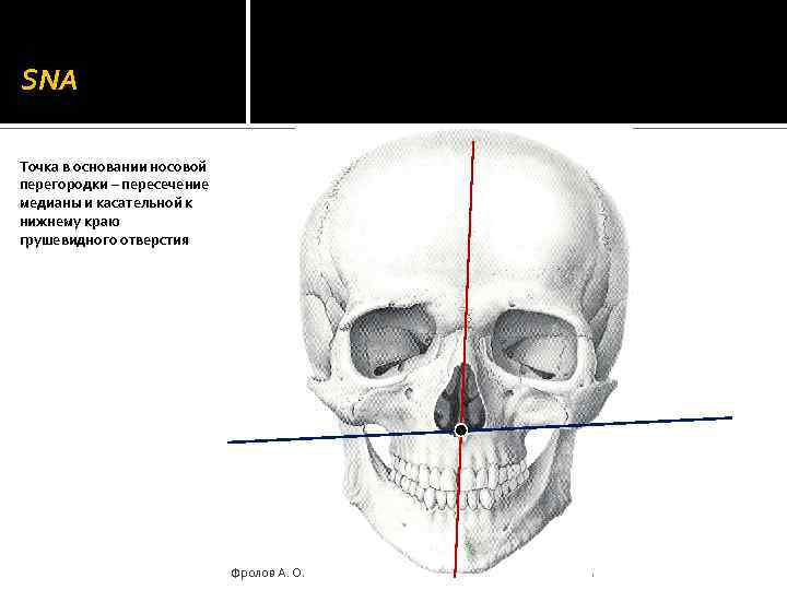 SNA Точка в основании носовой перегородки – пересечение медианы и касательной к нижнему краю