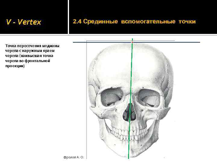 V - Vertex 2. 4 Срединные вспомогательные точки Точка пересечения медианы черепа с наружным