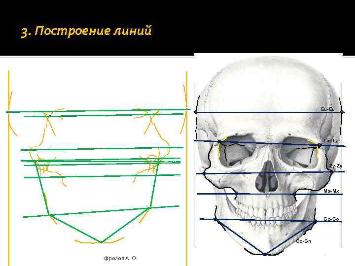 3. Построение линий Eu-Eu Lat-Lat Zy-Zy Ko-Ko Mx-Mx Ms-Ms C-C Zy-Zy Mx-Mx Go-Go Go-Gn