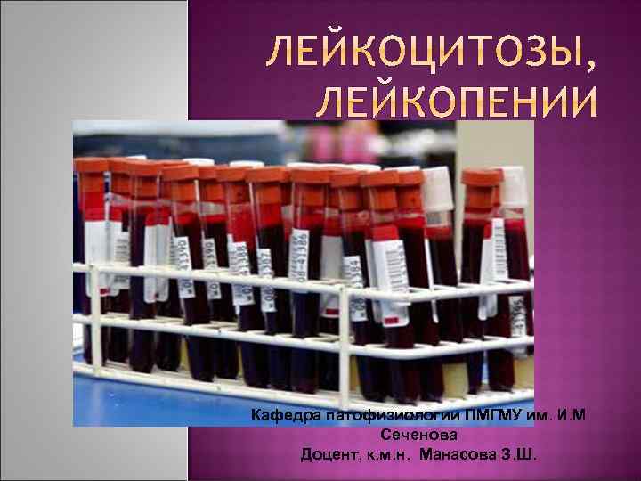 Кафедра патофизиологии ПМГМУ им. И. М Сеченова Доцент, к. м. н. Манасова З. Ш.