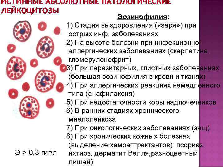 ИСТИННЫЕ АБСОЛЮТНЫЕ ПАТОЛОГИЧЕСКИЕ ЛЕЙКОЦИТОЗЫ Э > 0, 3 гиг/л Эозинофилия: 1) Стадия выздоровления (