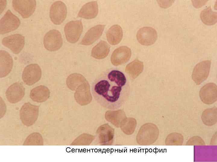 Сегментоядерный нейтрофил 