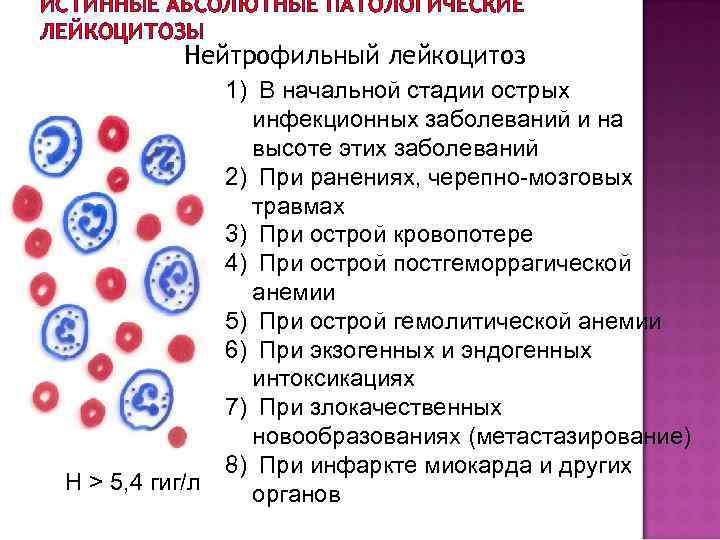 ИСТИННЫЕ АБСОЛЮТНЫЕ ПАТОЛОГИЧЕСКИЕ ЛЕЙКОЦИТОЗЫ Нейтрофильный лейкоцитоз 1) В начальной стадии острых инфекционных заболеваний и