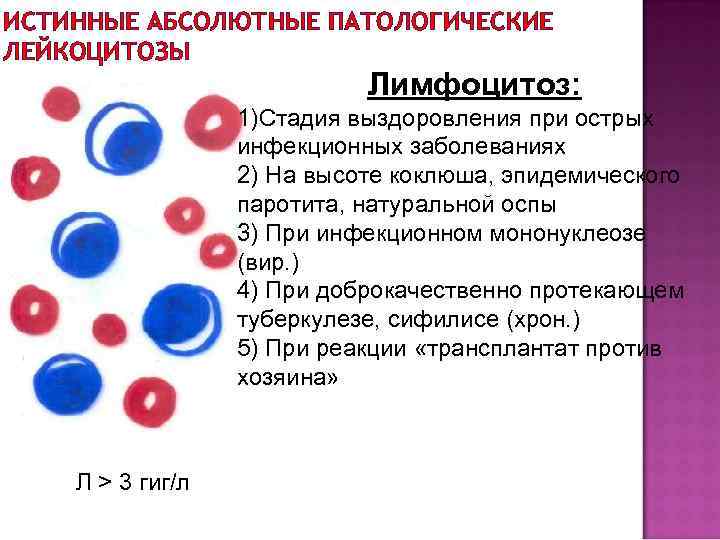 ИСТИННЫЕ АБСОЛЮТНЫЕ ПАТОЛОГИЧЕСКИЕ ЛЕЙКОЦИТОЗЫ Лимфоцитоз: 1)Стадия выздоровления при острых инфекционных заболеваниях 2) На высоте