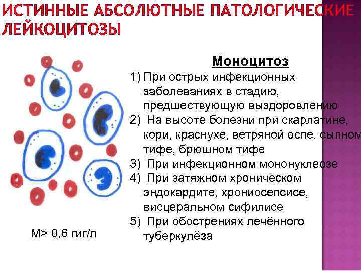 ИСТИННЫЕ АБСОЛЮТНЫЕ ПАТОЛОГИЧЕСКИЕ ЛЕЙКОЦИТОЗЫ Моноцитоз М> 0, 6 гиг/л 1) При острых инфекционных заболеваниях