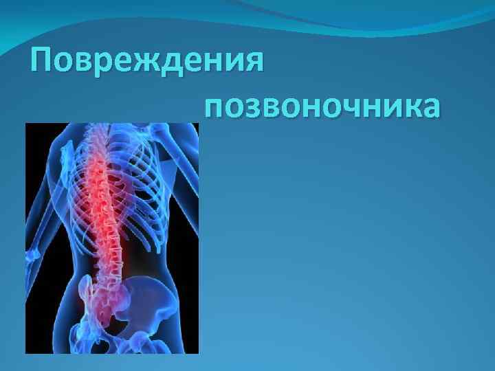 Травмы позвоночника. Повреждения позвоночника травматология. Травмы позвоночника презентация.