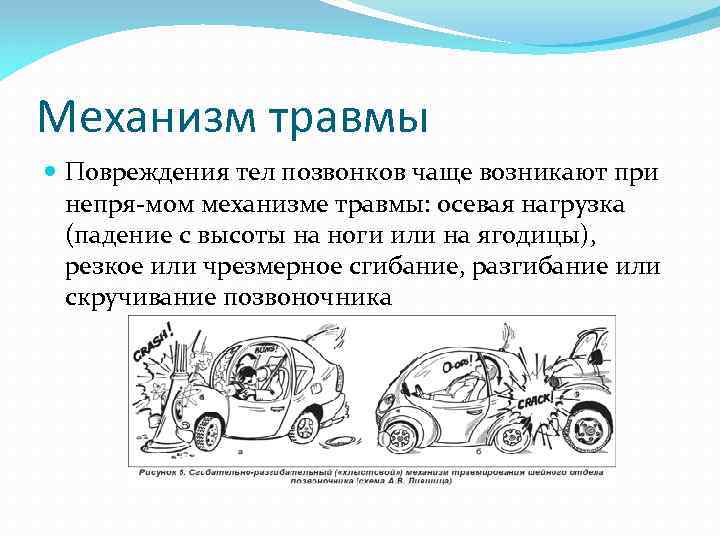 Механизм травмы Повреждения тел позвонков чаще возникают при непря мом механизме травмы: осевая нагрузка