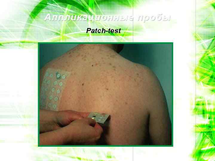 Аппликационные пробы Patch-test 