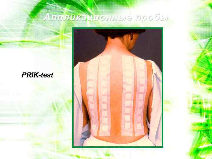 Аппликационные пробы PRIK-test 