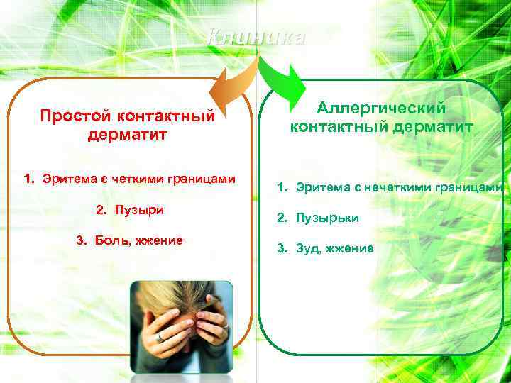 Клиника Простой контактный дерматит 1. Эритема с четкими границами 2. Пузыри 3. Боль, жжение