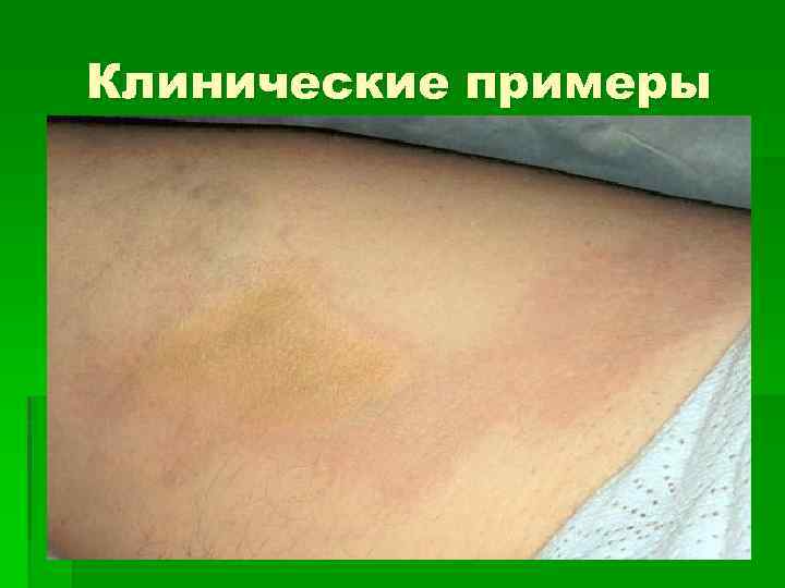Клинические примеры 