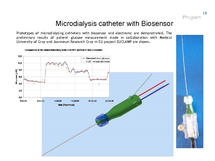Microdialysis catheter with Biosensor Prototypes of microdialysing catheters with biosensor and electronic are demonstrated.