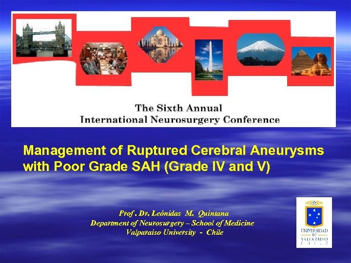 Management of Ruptured Cerebral Aneurysms with Poor Grade SAH (Grade IV and V) Prof.