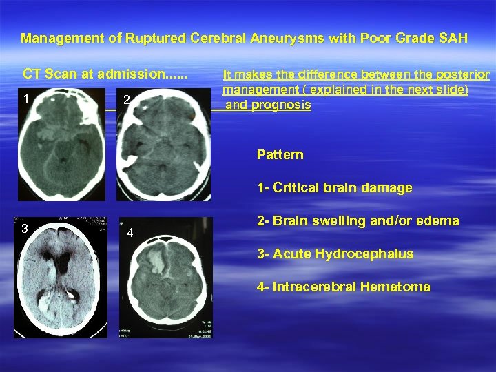 Management of Ruptured Cerebral Aneurysms with Poor Grade SAH CT Scan at admission. .
