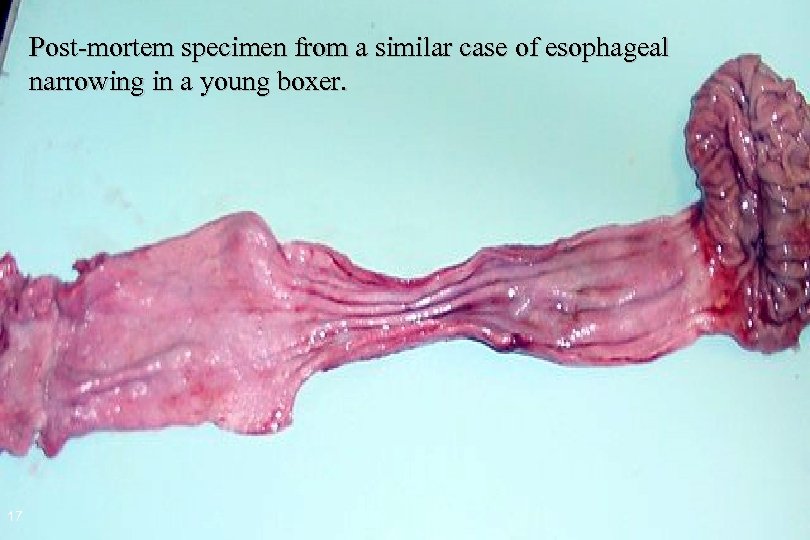 Post-mortem specimen from a similar case of esophageal narrowing in a young boxer. 17