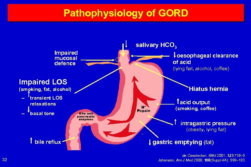 Pathophysiology of GORD salivary HCO 3 Impaired mucosal defence oesophageal clearance of acid (lying