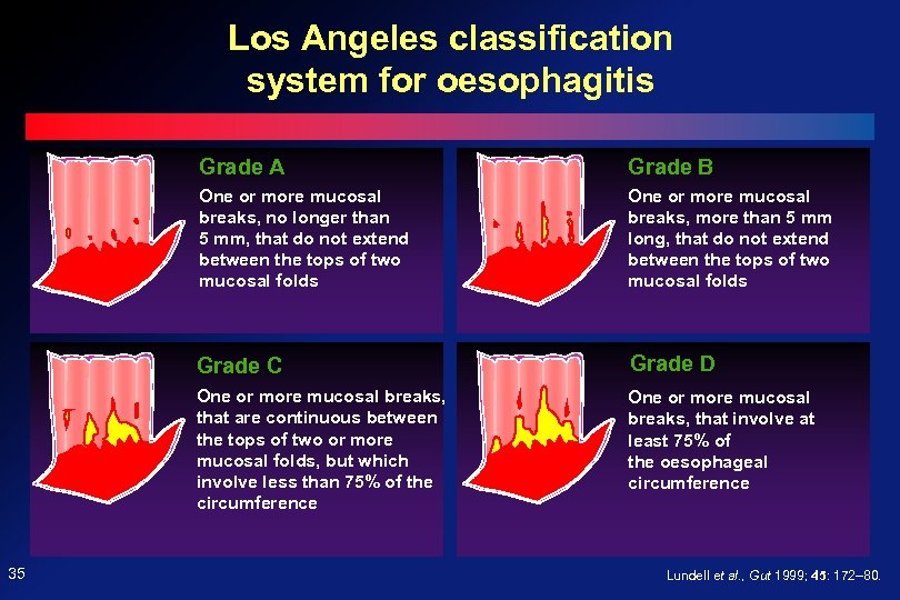 diseases-of-the-esophagus-prof-ferenc-szalay-md