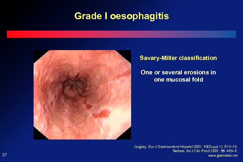 DISEASES OF THE ESOPHAGUS Prof Ferenc Szalay MD