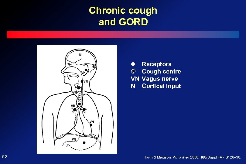 Chronic cough and GORD VN N 52 Receptors Cough centre Vagus nerve Cortical input