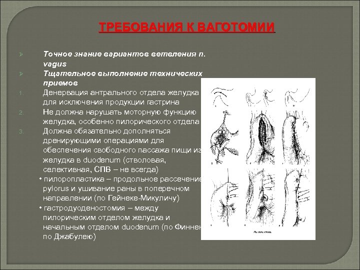 ТРЕБОВАНИЯ К ВАГОТОМИИ Ø Ø 1. 2. 3. Точное знание вариантов ветвления n. vagus