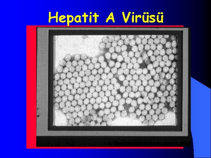 Hepatit A Virüsü 