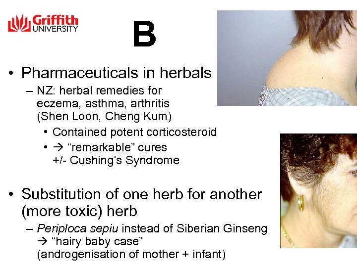 B • Pharmaceuticals in herbals – NZ: herbal remedies for eczema, asthma, arthritis (Shen