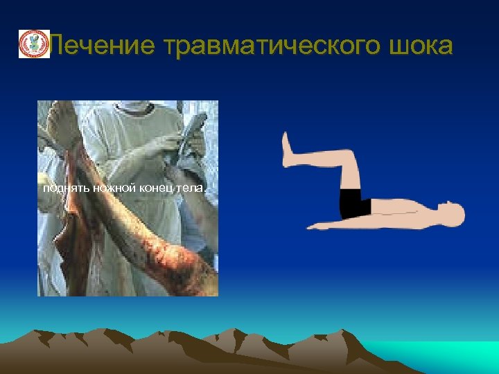 Лечение травматического шока поднять ножной конец тела. 