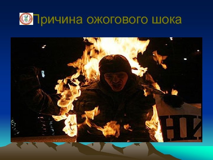 Причина ожогового шока 