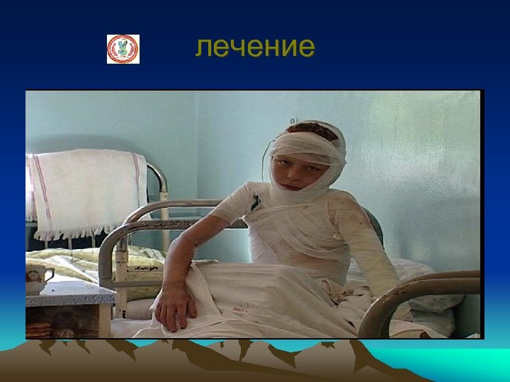 лечение 