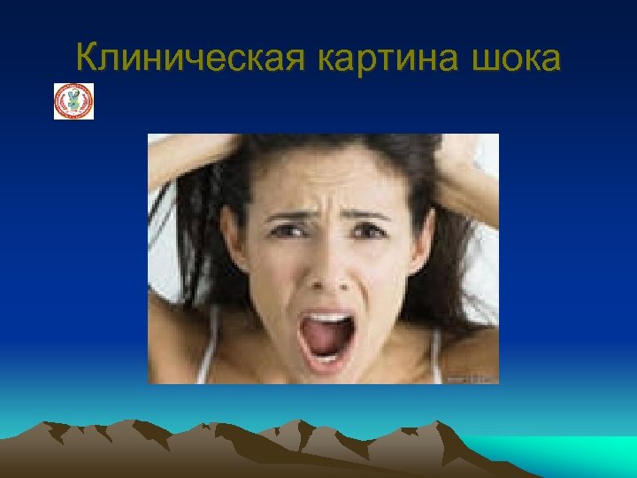 Клиническая картина шока 