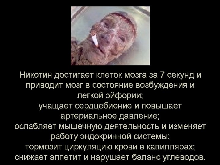 Никотин достигает клеток мозга за 7 секунд и приводит мозг в состояние возбуждения и