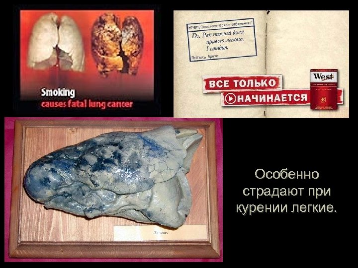 Особенно страдают при курении легкие. 